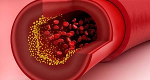 Red Blood Cells and Cholesterol