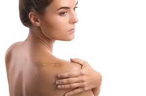 Women scar on Shoulder
