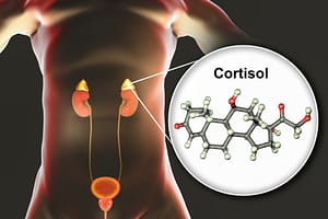 Cortisol levels