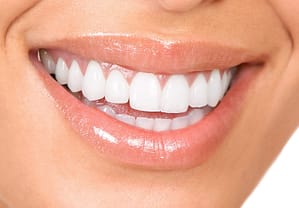 Girl is Smiling and showing Her White Teeth