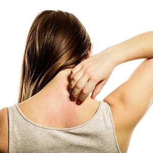 Women Having Skin Allergies